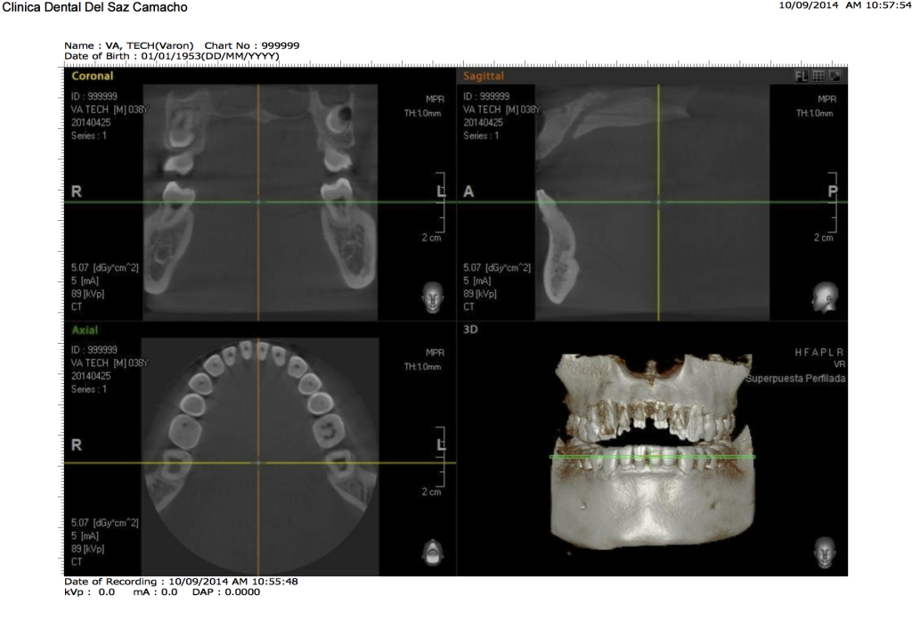 escaner dental1