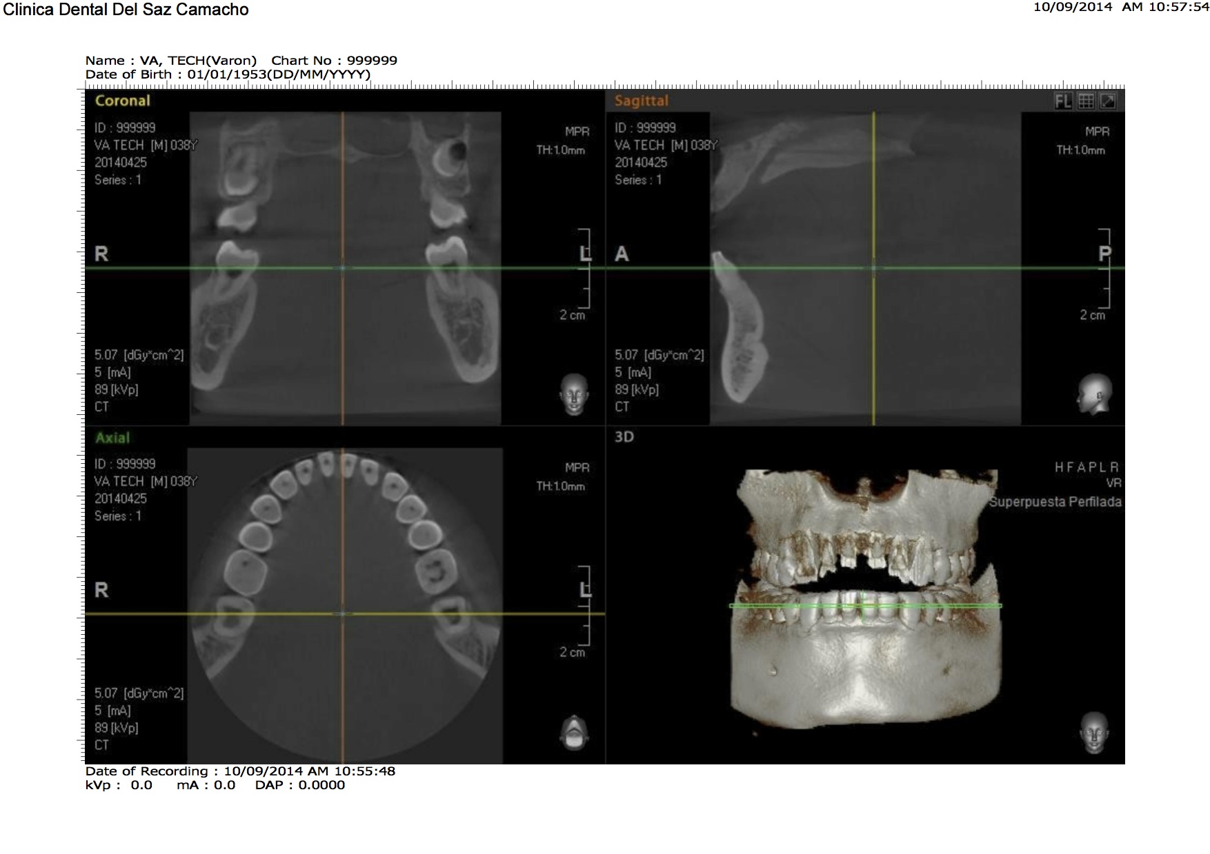 escaner-dental