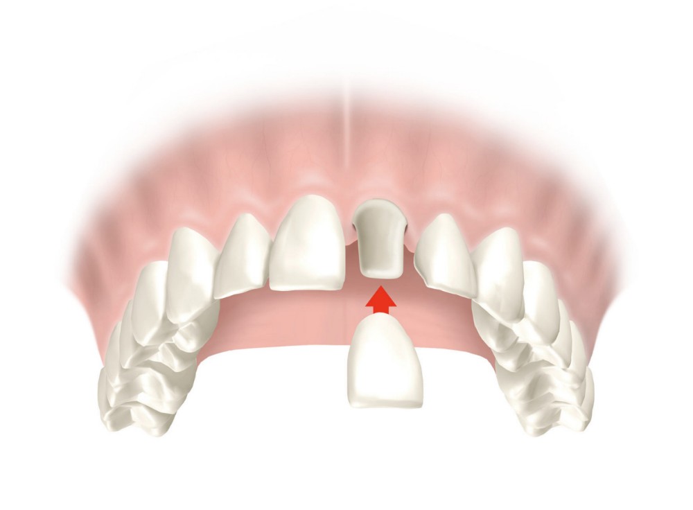 protesico-dental-madrid