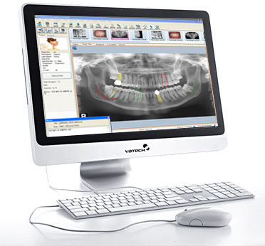 software-imagen-dental